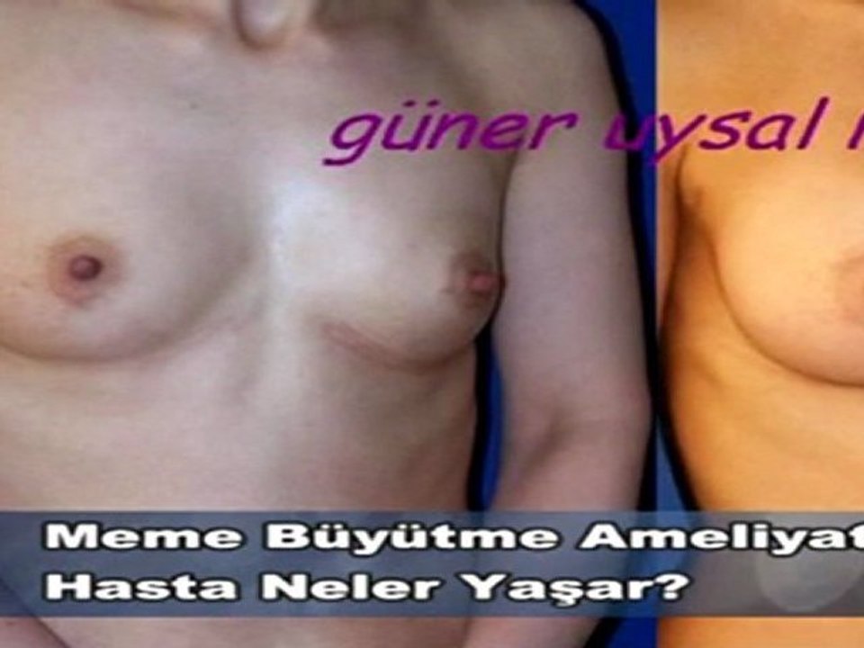 Meme Büyütme