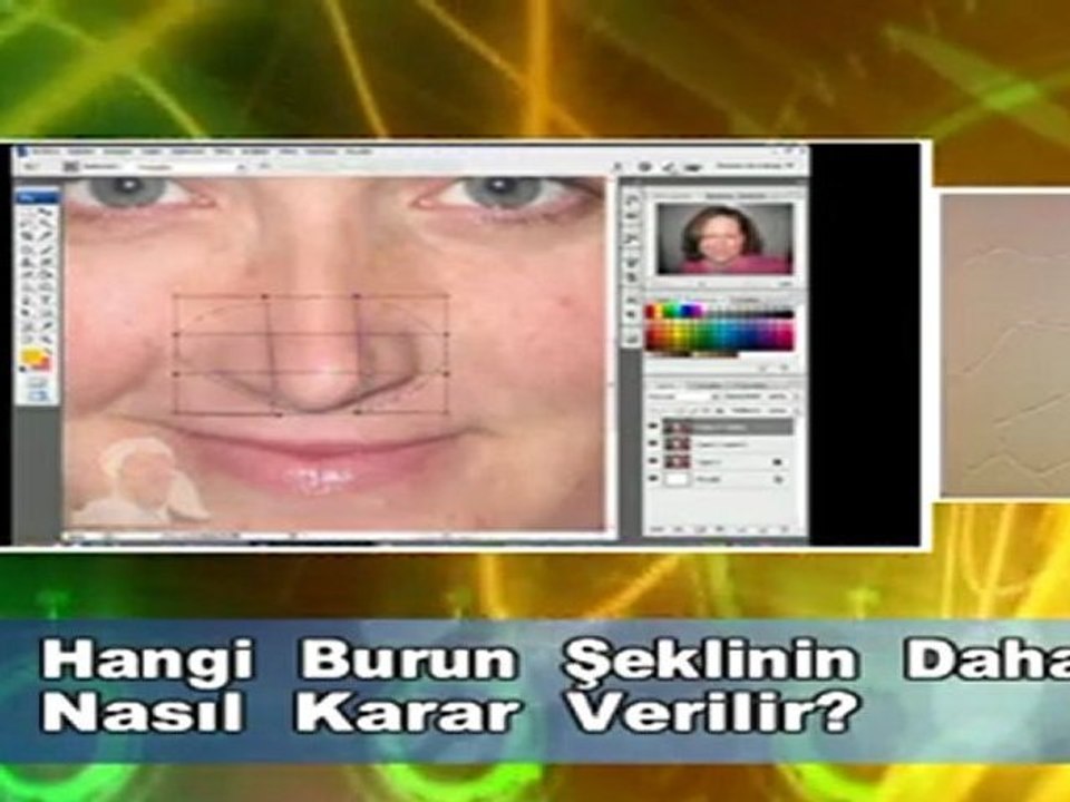 Dr. Güner Uysal Burun Şekline Karar Verilmesi