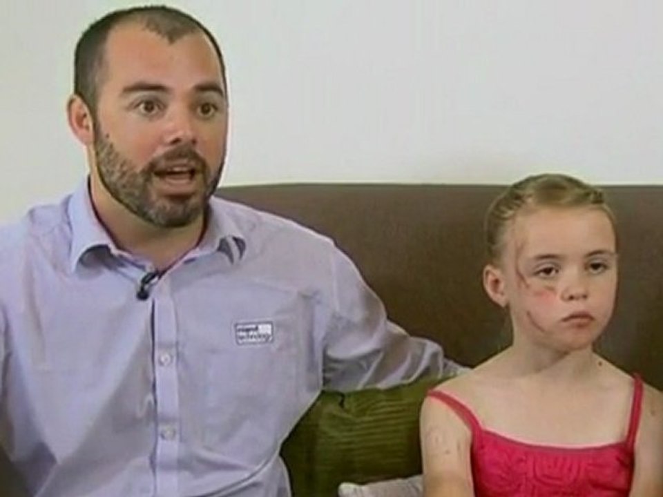Girl recovers after kangaroo attack