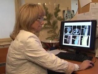 Što su sve  liječnici izvadili iz pacijenata