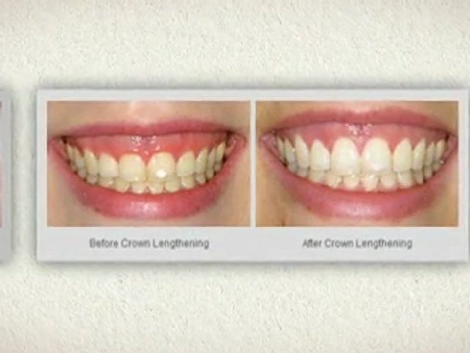 Periodontist Seattle