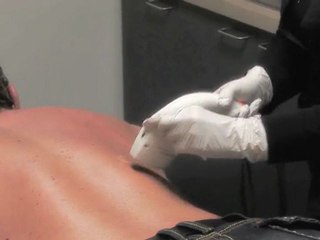 Male Laser Hair Removal San Diego