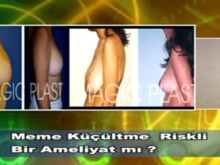 Dr. Güner Uysal Meme Küçültme Ameliyatı Risklimidir
