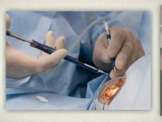 Eye Doctor Hartford CT