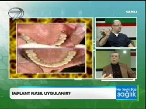 DR.NİHAT TANFER KANAL7 HERSEYIN BASI SAGLIK 21_01_2012