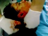 فري برس   حمص المحتلة الوعر مجزرة الشبيحة في الوعر الشهيدة هند طيبة 3 12 2011 ج2