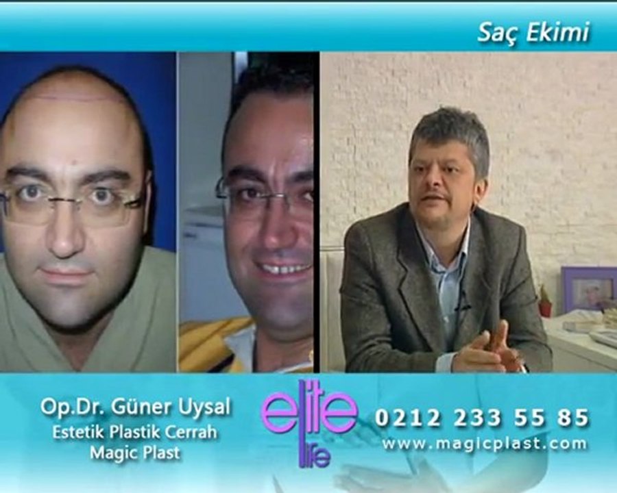 Saç Ekimi