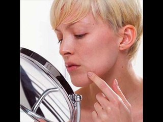 Home remedies for acne scars