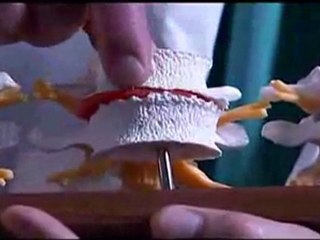 Laser Spine Institute's Dr. Gruber on Exercise and Proper Body Mechanics