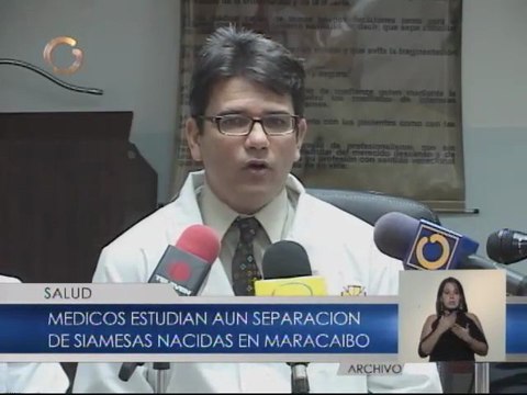 Estudian separación de siamesas zulianas unidas por abdomen y tórax
