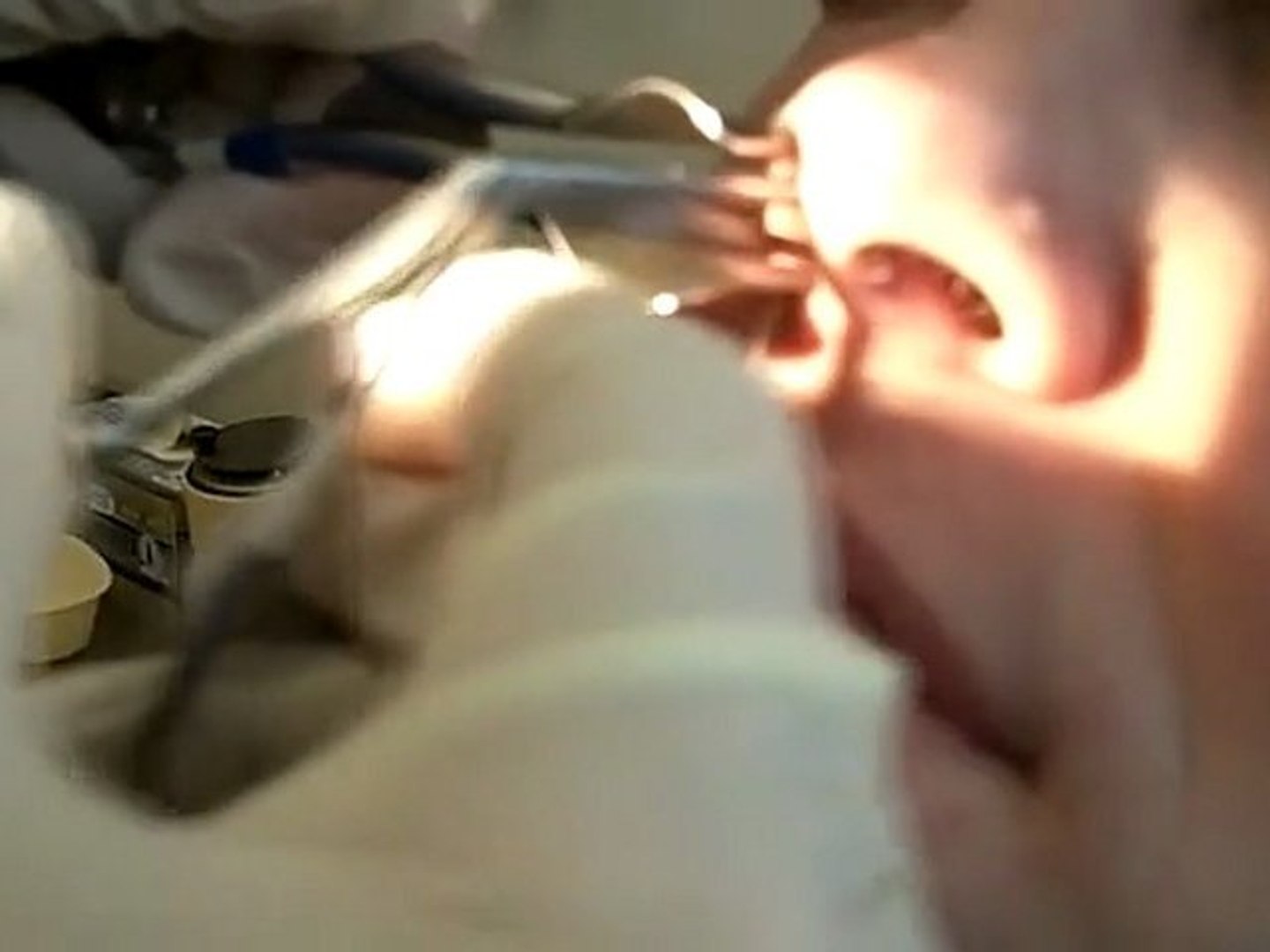 Video Insolite Une Crotte De Nez Geante Sort De Son Nez Video Dailymotion