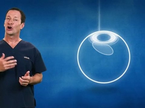 Dr Pierre Demers de LASIK MD explique « Comment fonctionne l'intervention? »