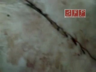 حتى ذوي الاحتياجات الخاصة لم يسلموا من نظام بشار 22-5-2011