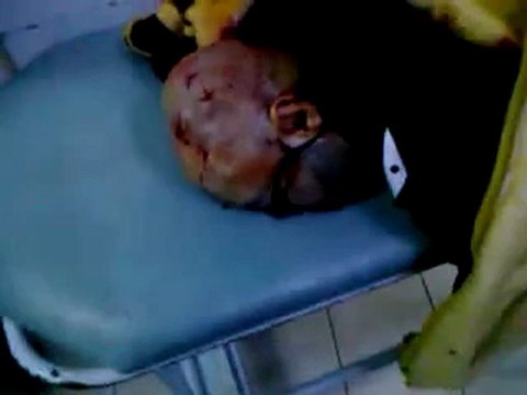 فري برس حمص المحتلة الوعر مجزرة الشبيحة في الوعر الشهيد محمد طيبة 3 12 2011