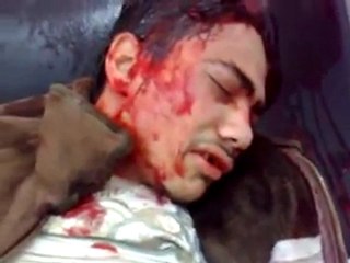 فري برس   حمص البياضةجريح بحالة خطرة جدا جدا 6 12 2011