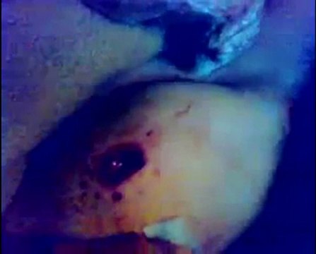 فري برس حمص باب تدمر احدى الاصابات جراء اطلاق الرصاص العشوائي 7 12 2011