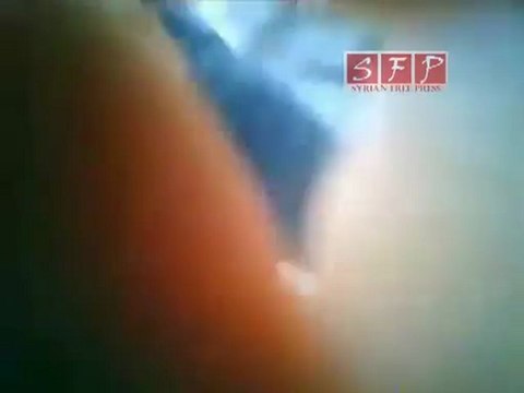 حلب اصابة احد المتظاهرين بساقه بعد اطلاق النار 12-8-2011