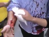 فري برس   حمص  باب السباع  هام جداً الجرحى اللذين سقطوا إثر إنفجار قنبلة مسمارية ضربها رجال الأمن على المصلين عند الخروج من المسجد 7 10 2011