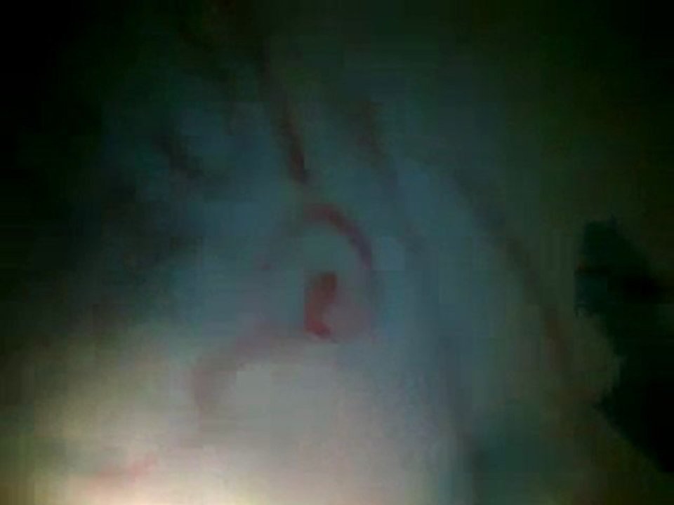 فري برس   خربة غزالة  حملة الرجل البخاخ اليومية ج1