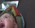 فري برس    حمص باباعمرو   طفل مصاب أثر إطلاق قنبلة مسمارية 6 11 2011