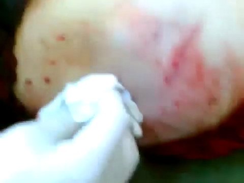 فري برس حمص باباعمرو طفلة شهيدة في القصف على الحي 7 11 2011