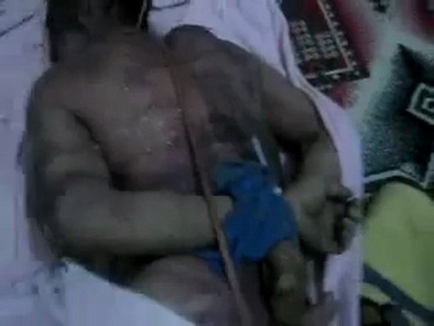 فري برس حمص دير بعلبة الشهيد مصطفى العلي زيدان ثالث ايام العيد 8 11 2011