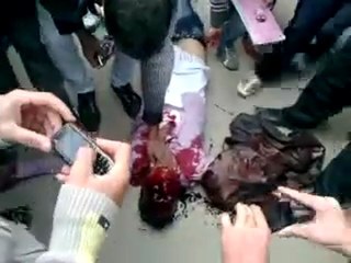 فري برس   حماة شهيد برصاص عصابات الامن بعد اصابته في الراس 13 11 2011