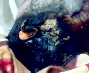 فري برس   صور التعذيب الوحشي على جثماني الشهيدين عبدالله خير الله و جمال عليوي في قلعة المضيق