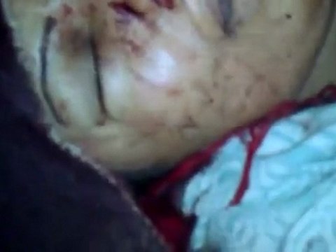 فري برس الحولة الشهيدة صباح أحمد الأحمد التي استشهدت برصاص قناصة عصابات الاسد 21 11 2011