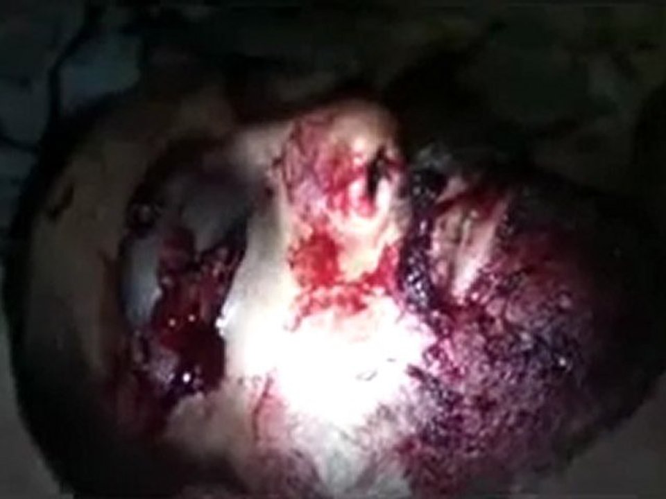 فري برس   الشّهيد البطل محمّد غسّان عبّارة 28 11 2011 ج2