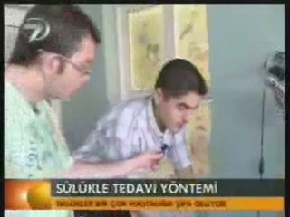 sülük tedavisi