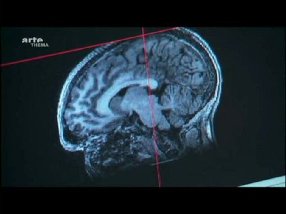 Les étonnants pouvoirs de transformation du cerveau (Partie 2/2)