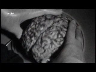 Les étonnants pouvoirs de transformation du cerveau (Partie 1/2)
