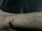 فري برس   اصابة شاب في وادي العرب 2 1 2012