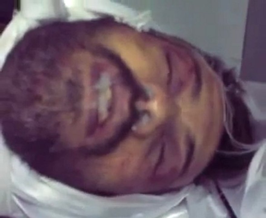 فري برس   الشهيد محمد سعيد سحلول آثار التعذيب واضحة عليه 2 1 2012
