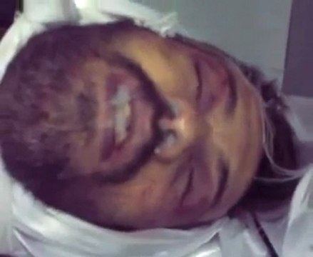 فري برس الشهيد محمد سعيد سحلول آثار التعذيب واضحة عليه 2 1 2012