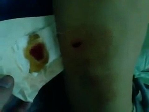 فري برس أحد مصابي جامع الرفاعي جمعة ان تنصروا الله ينصركم 6 1 2012