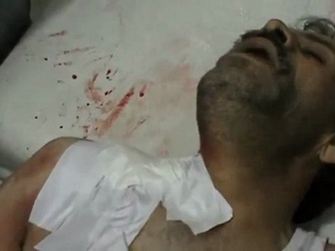 فري برس كرم الزيتون إصابة رجل مسن بطلقة قناص