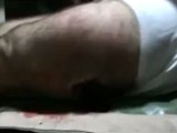 فري برس   اصابة رجل في وادي العرب اصابة قوية11 1 2012