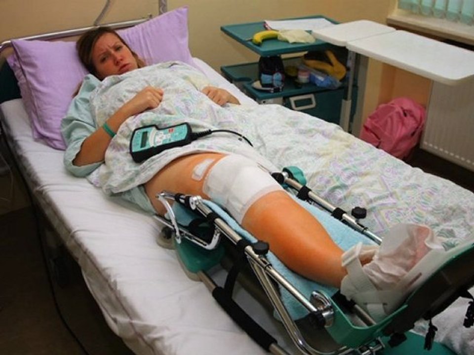 What Injuries Can I Claim In Bicycle Accident Claim Or Lawsu