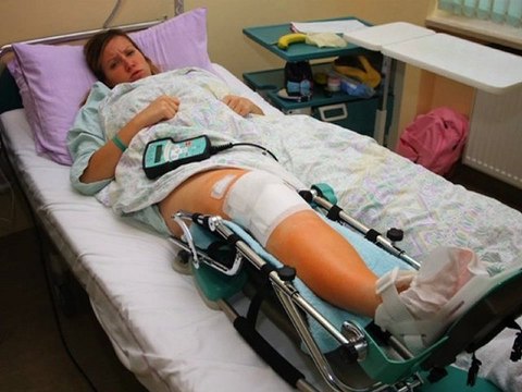 What Injuries Can I Claim In Bicycle Accident Claim Or Lawsu