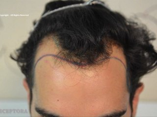 FUE 3100 UFs Dr Lupanzula (MeDiKemos)-ESP