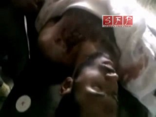 الشهيد محمد السويد طلق ناري من قناص 5-7-2011