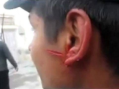 فري برس شوف الرصاص و حكمة ربك جمعة اضراب الكرامة مدينة ضمير 9 12 2011