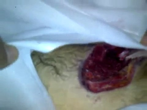 فري برس حمص الحولة الشهيد مؤيد محمد نور القاسم 17 12 2011