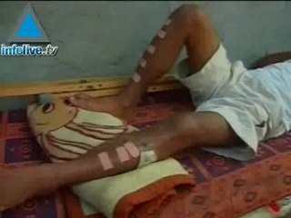 Hamas Tortures Fatah officials in Gaza