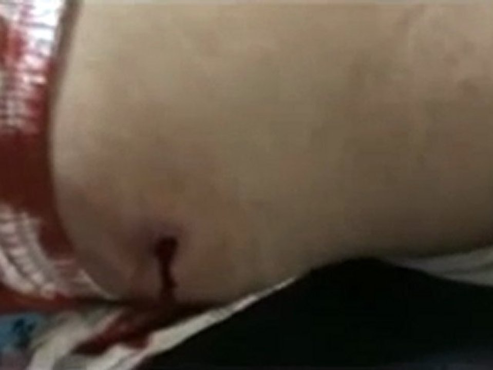 فري برس  حمص وادي العرب إصابة أحد المواطنين برصاص القناص 3 1 2012