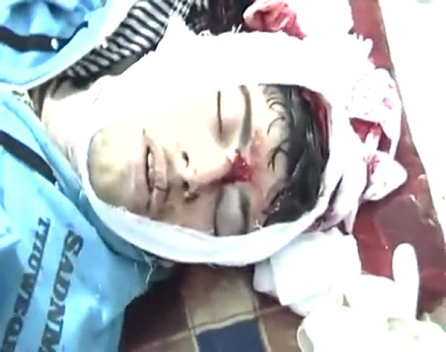 فري برس   حمص كرم الزيتون الشهيد خالد زياد ستيت يلفظ انفاسه +18