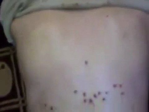 فري برس دمشق المزة جمعة معتقلي الثورة إصابة برصاص الأمن 20 1 2012