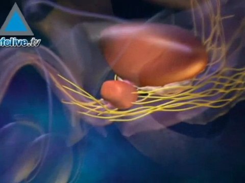 Beilinson hospital: Da Vinci is a robotic surgical system